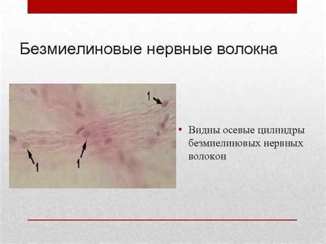 Нервная ткань Клетки нервные волокна нервные окончания