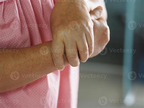 woman holding hands rare disorder body immune system attacks nerves