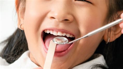 Rising number of dental decay in children in North Carolina | wcnc.com