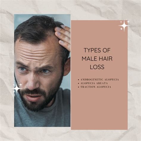 how to treat hair loss in male