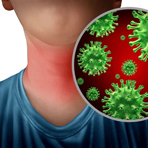 Dor De Garganta Virus Ou Bacteria