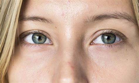 eye surgery qazi clinic