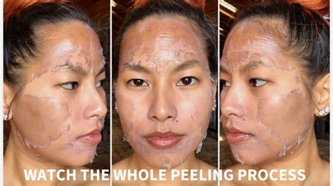 face  peeling      dollie guth blog