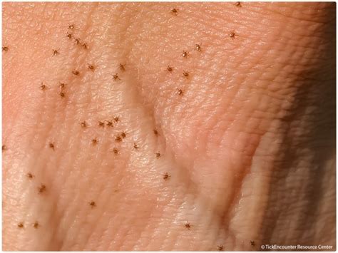 seed tick larvae identification wolfjumbo