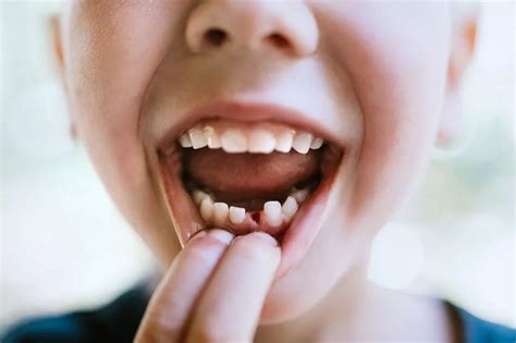 Когда выпадают молочные зубы – статьи детской стоматологической клиники ...