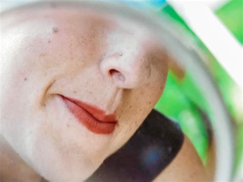 mole removal singapore guide   expect