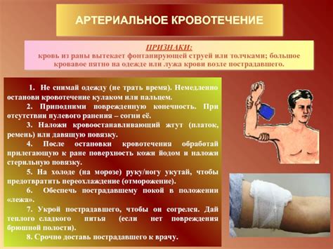 Виды кровотечений.Первая помощь при кровотечениях