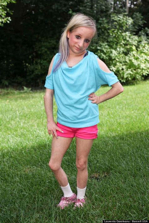 'It Doesn't Mean I'm Any Different': Teen Born With Primordial Dwarfism ...
