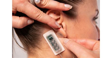 fda clears dyansys neurostimulation device  relief  treat