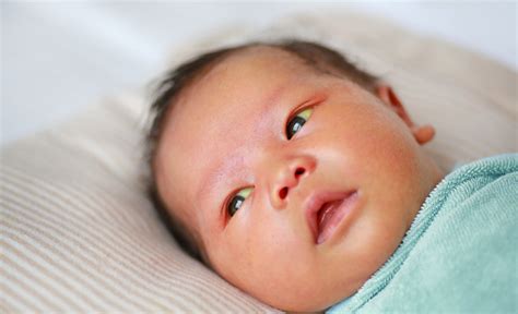 Recém-nascido Com Olho Amarelo O Que Fazer - Icterícia Neonatal | Recém-nascido | Bolas de Sabão