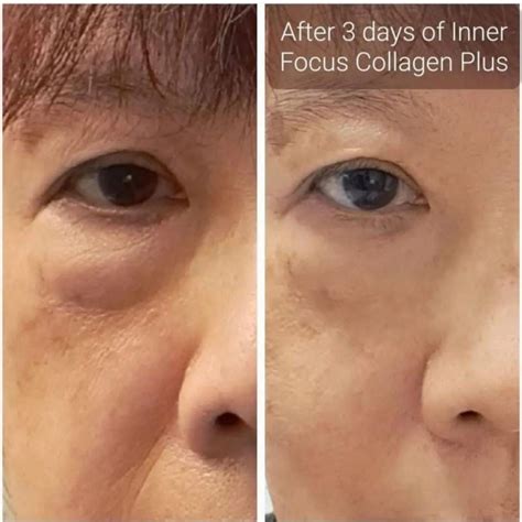 "Beauty Collagen+"