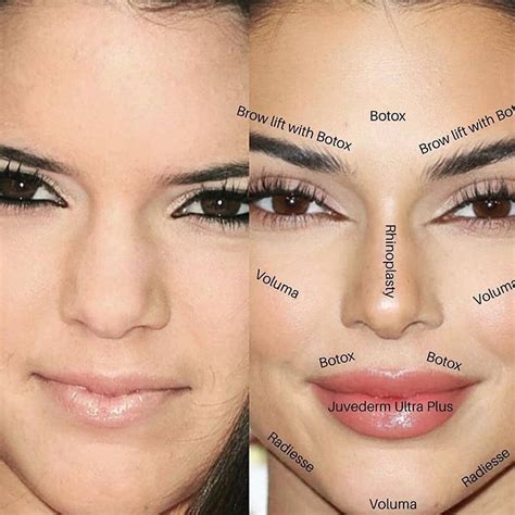 What did Kendall have done? Here are some possibilities... Agree? 👇👇 ...