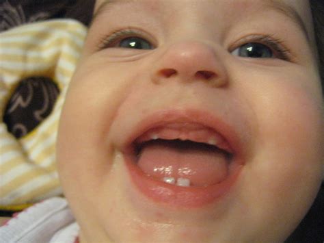 Зубы :))) нестандарт :))) — 43 ответов | форум Babyblog