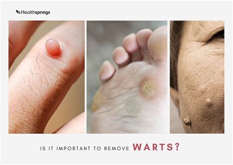 7 Types of Common Skin Bumps (Causes & Treatments)