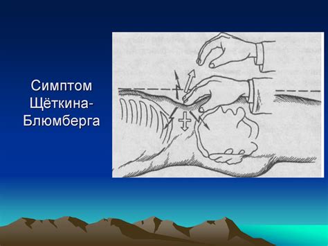 Острые хирургические заболевания брюшной полости - презентация онлайн