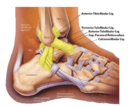 Ankle Ligament Repairs | Aptiva Health