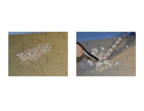 technical strategies diced rib graft injection  rhinoplasty