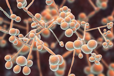 Vulvovaginal Candidiasis - DTAP Clinic