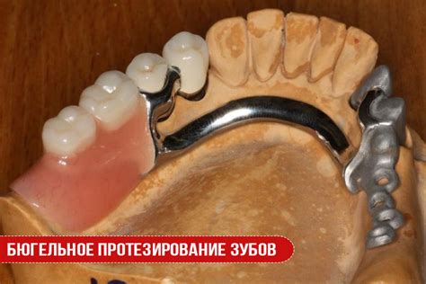 Протезирование: новости, технологии и опыт пациентов