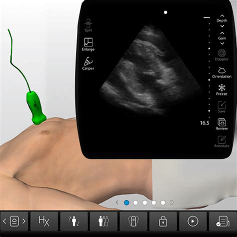 Pericardiocentesis Procedure - Ultrasound-Guided Technique