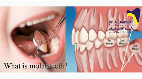 What is a molar teeth? - Dr Jamilian