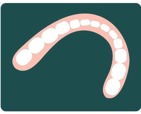 removable denture allondentalcom