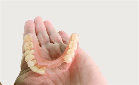 When dentists should use flexible partial dentures - Dandy