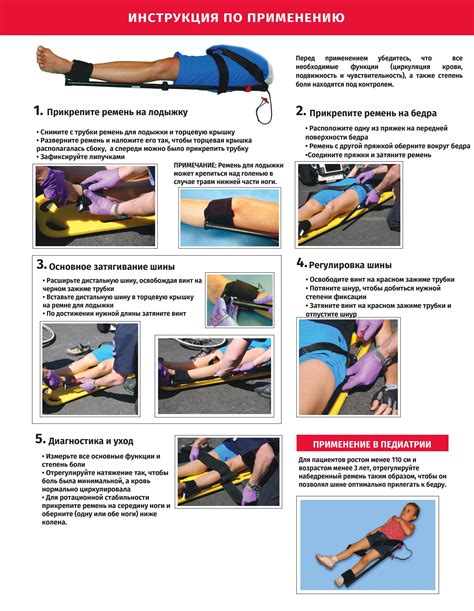 Иммобилизационная шина Slishman Traction Splint