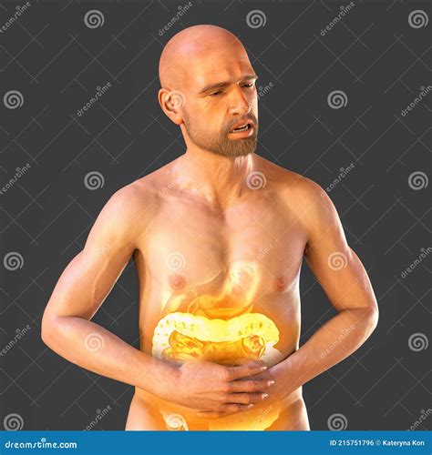 Abdominal Pain and Cramping in a Male Patient because of Irritable