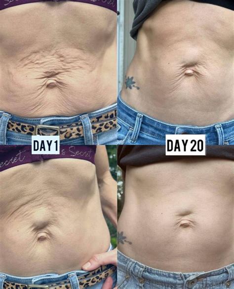 Success Stories - LifeVantage