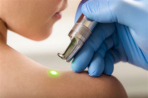 Laser Advancements Transform Skin Rejuvenation – on305