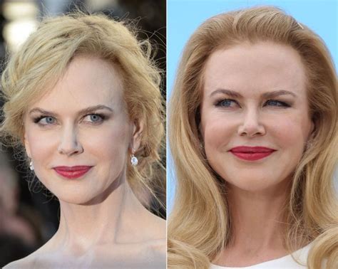 Uncovering The Truth Behind Nicole Kidman's Alleged Surgeries
