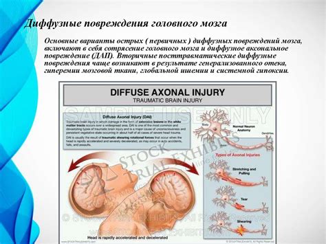 Клиника. ЧМТ - презентация онлайн