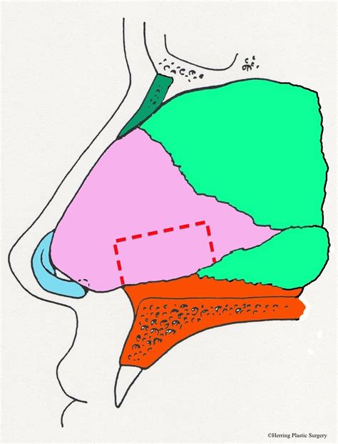 Septal Cartilage