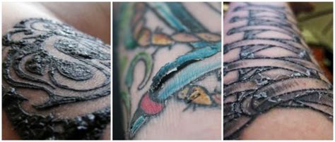 É Normal A Tatuagem Descascar Com 3 Dias - Tatuagem descascando – O que fazer? + Principais cuidados!