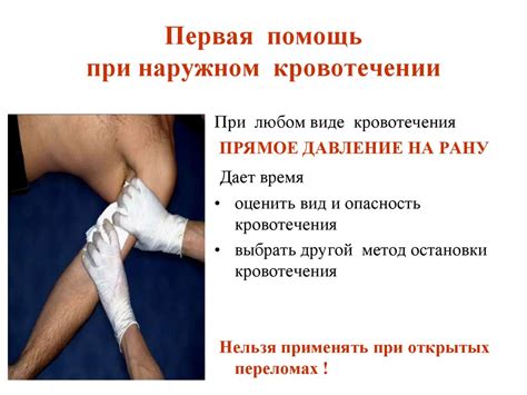 Первая помощь при открытых травмах и кровотечении - презентация онлайн