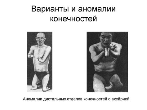 Скелет туловища и конечностей - презентация онлайн
