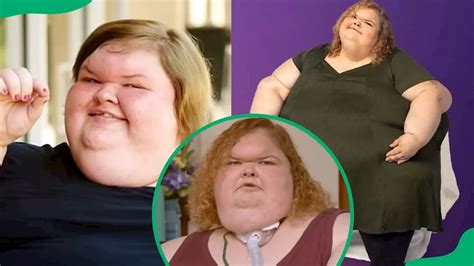 1000-Pound Sisters, Tammy Slaton's forehead: All about her condition
