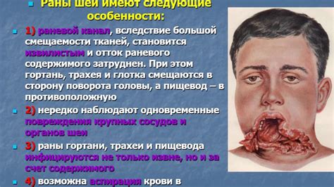 Тема 12 (ЛФ-1) - Топографическая анатомия шеи. Оперативная хирургия шеи ...
