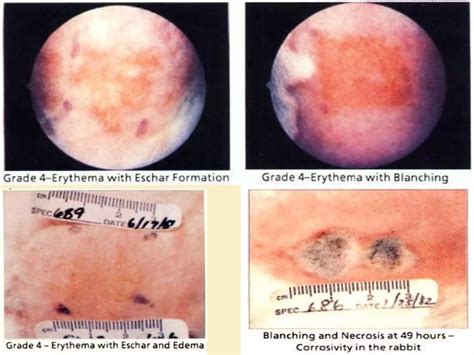 Acute dermal irritation/corrosion: OECD 404 | PPTX