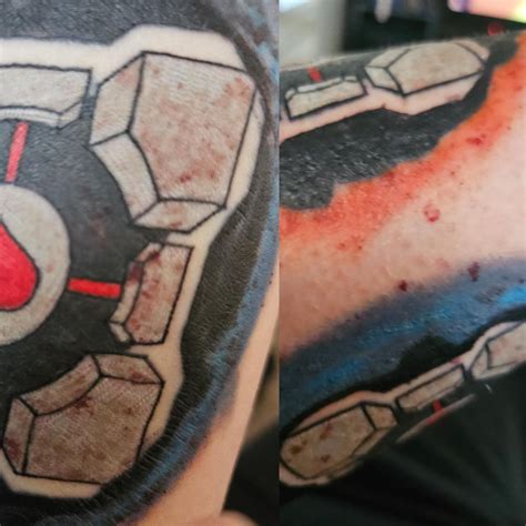 Fresh Tattoo, Infection? Allergic reaction? : r/medical_advice