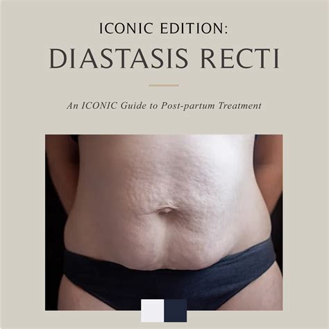 💡Diastasis Recti weakens and... - ICON Aesthetics Singapore