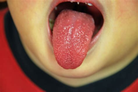 What Your Tongue Can Tell You About Your Health – My Health Maven