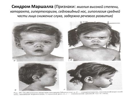 Методы изучения наследственности человека (генеалогический ...