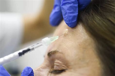 Dermatolog Beograd | Najbolji Dermatolog Beograd | Dermatim