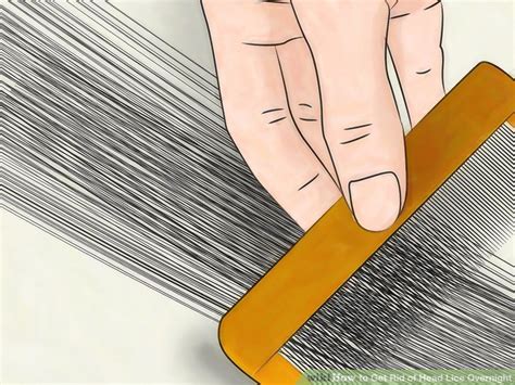 how to get rid of lice in your hair
