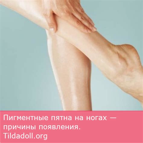 Пигментные пятна на ногах от чего и что делать. Что делать с пятнами на ...