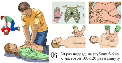Непрямой Массаж Сердца: Правильная Техника Проведения