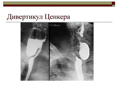 Методы лучевой диагностики. Лучевая диагностика ЖКТ - online presentation