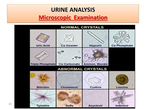 urinalysis powerpoint    id